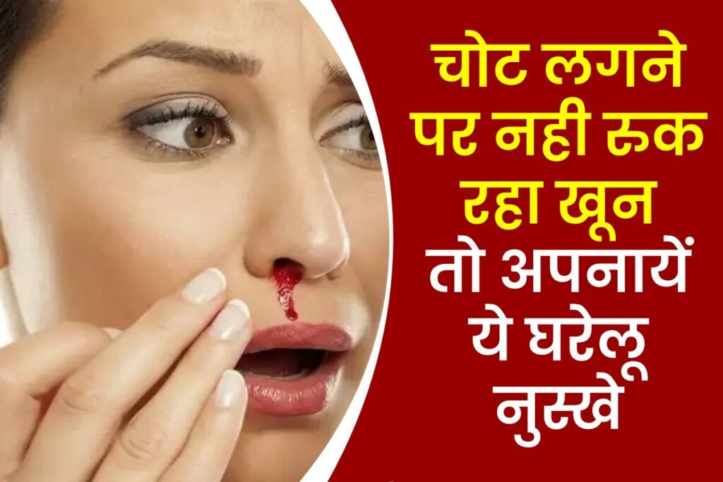 चोट लगने पर नही रुक रहा खून तो अपनायें ये घरेलू नुस्खे - Home remedies to stop bleeding in Hindi