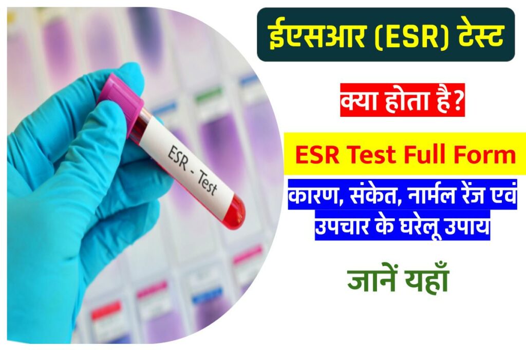 ESR Test In Hindi